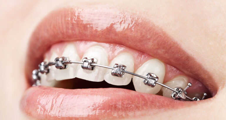 dis-teli-varken-cips-yenir-mi