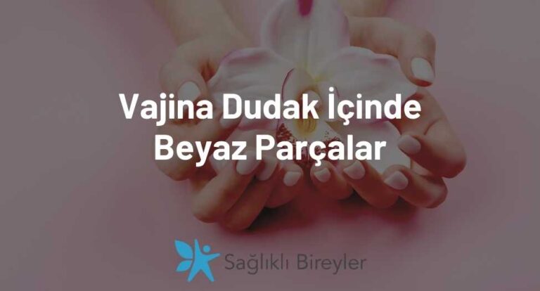 Vajina Dudak İçinde Beyaz Parçalar