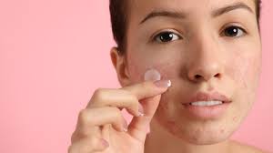 Cilt Lekeleriyle Mücadelenin Önemi Cilt Lekeleriyle Mücadelenin Önemi