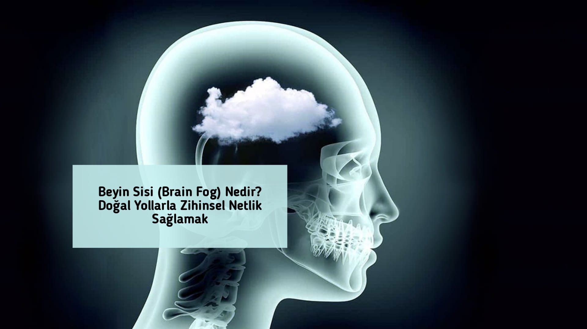 Beyin Sisi (Brain Fog) Nedir? Doğal Yollarla Zihinsel Netlik Sağlamak