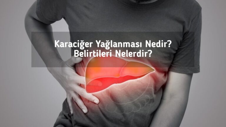 Karaciğer Yağlanması Nedir? Belirtileri Nelerdir?