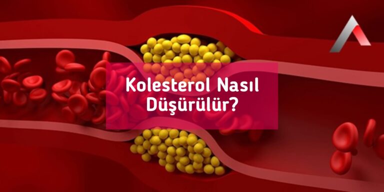 Kolesterol Nasıl Düşürülür?
