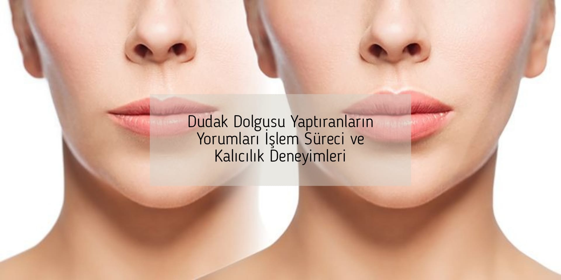 Dudak Dolgusu Yaptıranların Yorumları İşlem Süreci ve Kalıcılık Deneyimleri