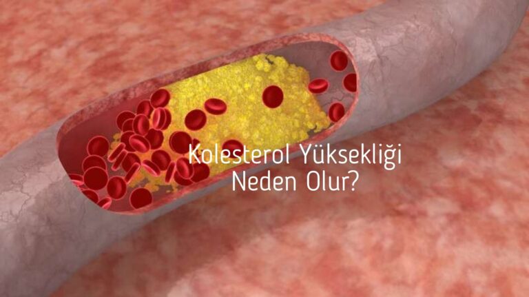 Kolesterol Yüksekliği Neden Olur?