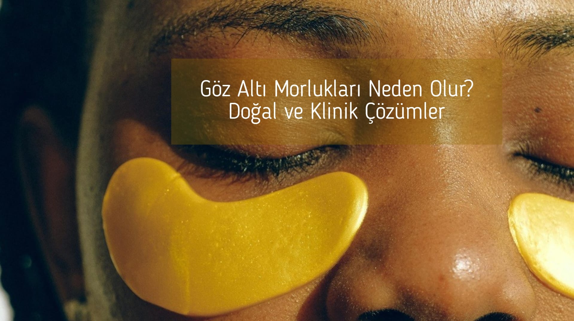 Göz Altı Morlukları Neden Olur? Doğal ve Klinik Çözümler