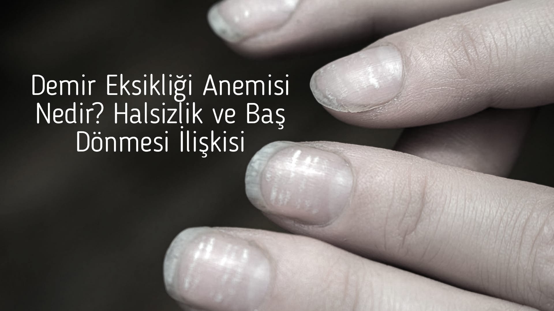 Demir Eksikliği Anemisi Nedir? Halsizlik ve Baş Dönmesi İlişkisi