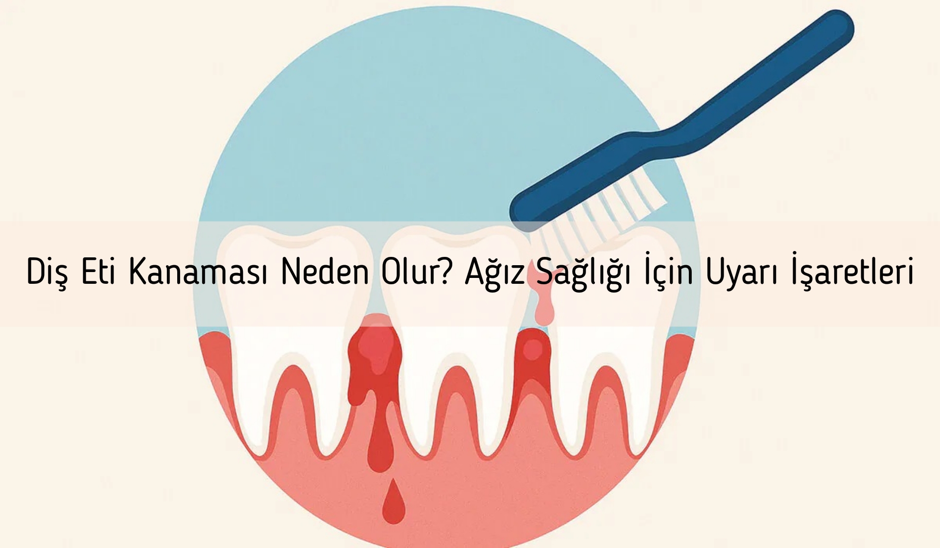 Diş Eti Kanaması Neden Olur? Ağız Sağlığı İçin Uyarı İşaretleri