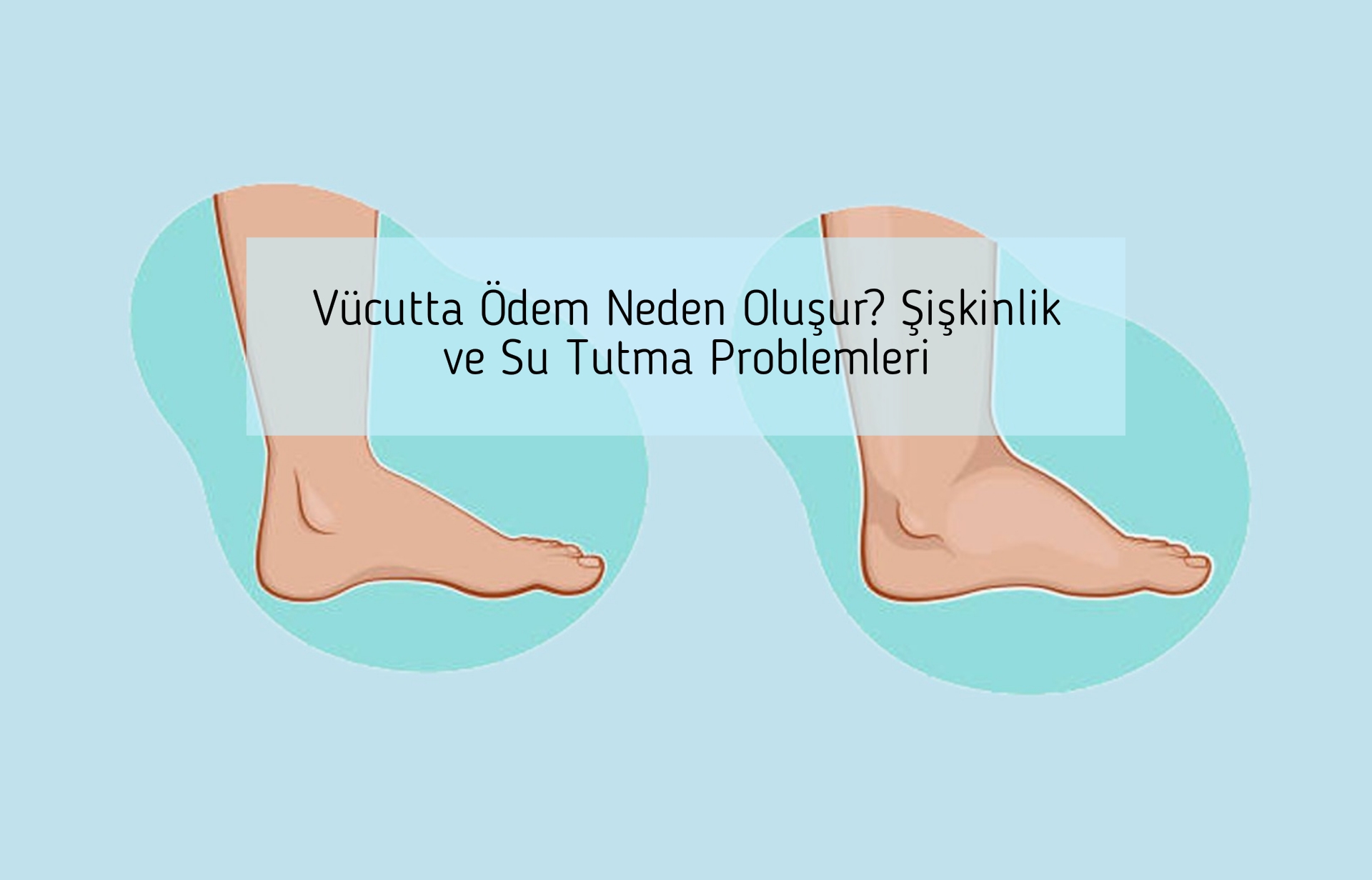 Vücutta Ödem Neden Oluşur? Şişkinlik ve Su Tutma Problemleri