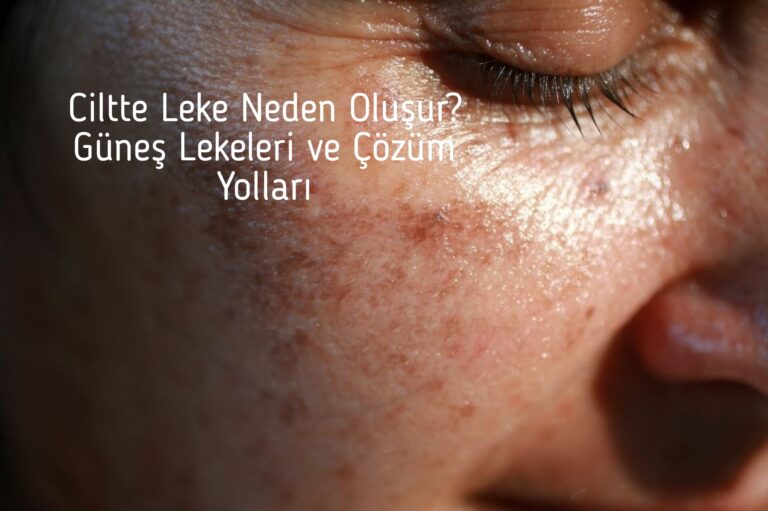 Ciltte Leke Neden Oluşur? Güneş Lekeleri ve Çözüm Yolları