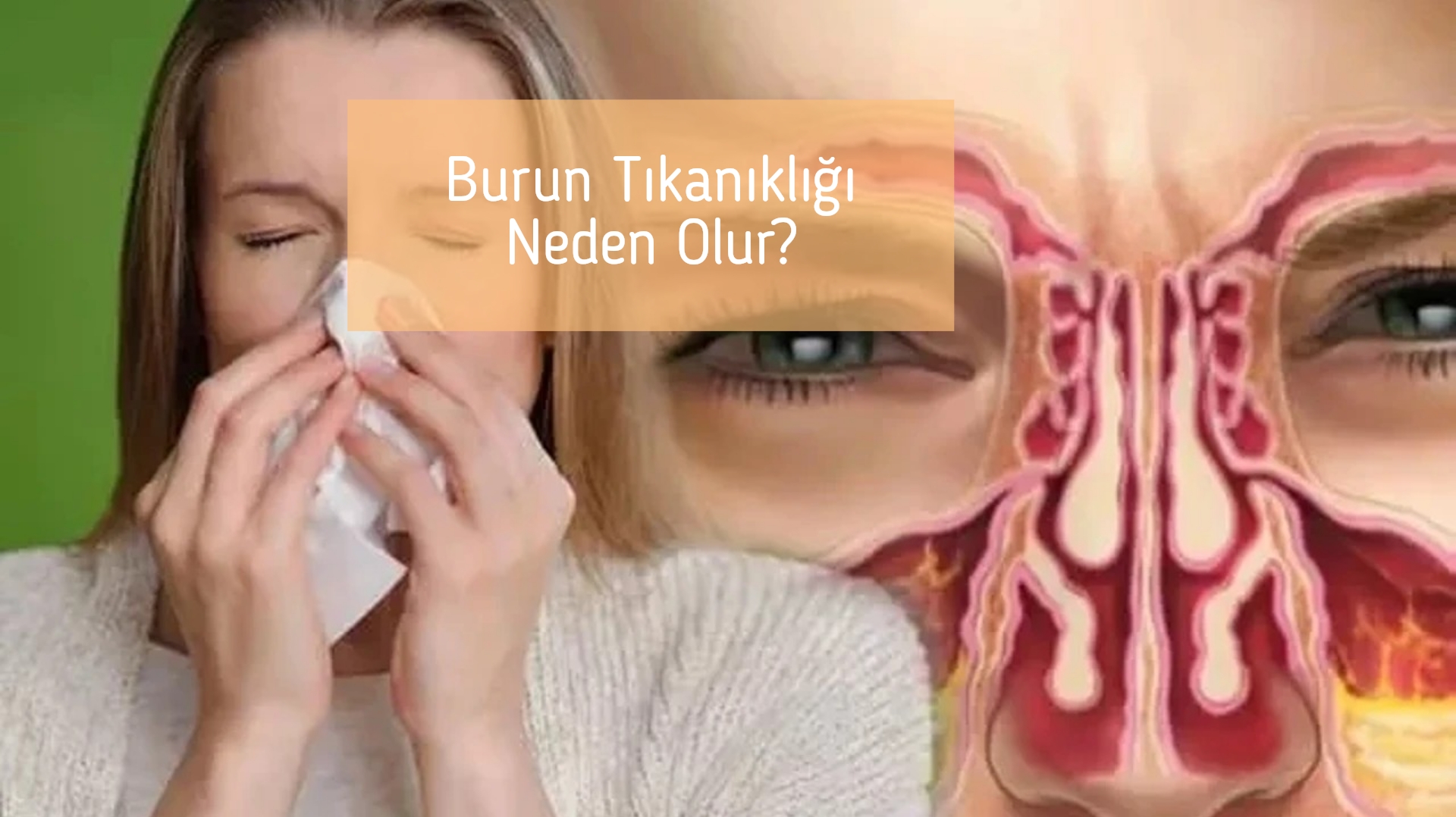 Burun Tıkanıklığı Neden Olur?