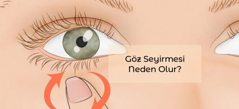 Göz Seyirmesi Neden Olur
