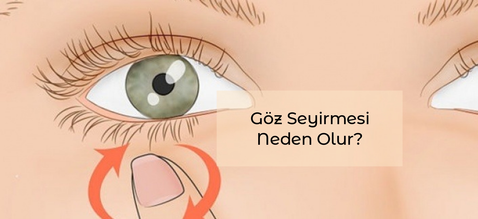 Göz Seyirmesi Neden Olur